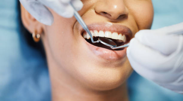 Best Emergency Root Canal Therapy in Somerset, OH